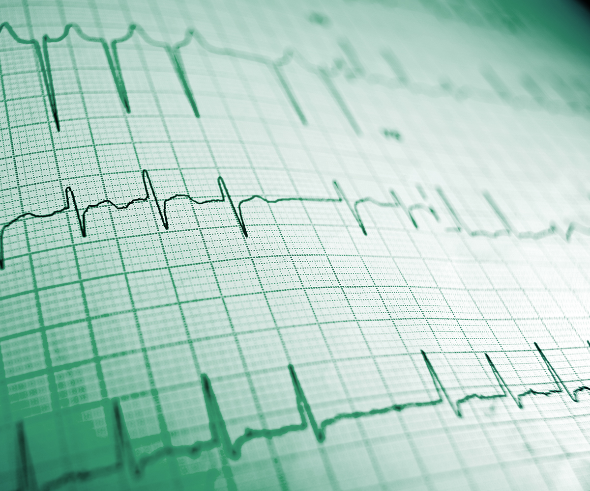 CARDIAC ASSESSMENT - Sports Cardiology Ireland